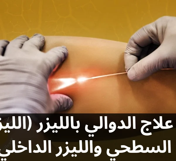 علاج الدوالي بالليزر الليزر السطحي والليزر الداخلي 20250209 191539 0000