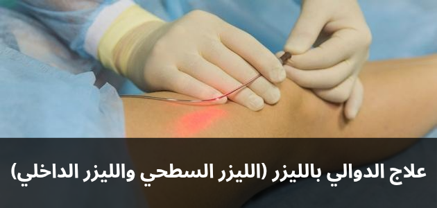 علاج الدوالي بالليزر الليزر السطحي والليزر الداخلي 20250209 191710 0000