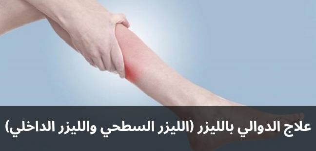 علاج الدوالي بالليزر الليزر السطحي والليزر الداخلي 20250209 191831 0000