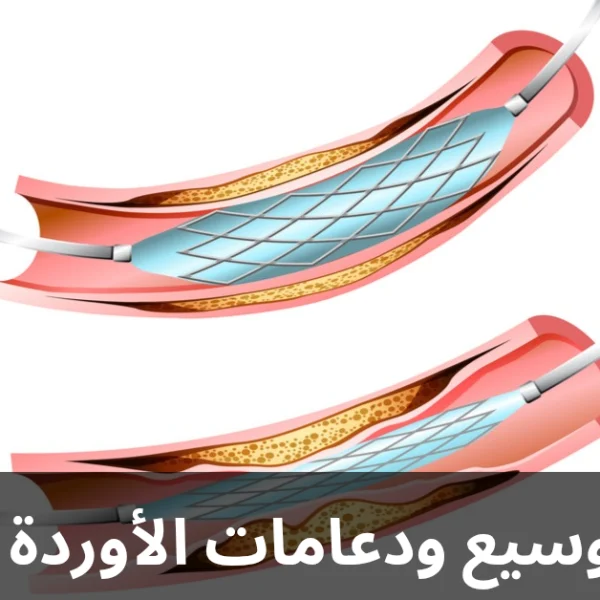 قسطرة توسيع ودعامات الأوردة الطرفية 20250303 235637 0000