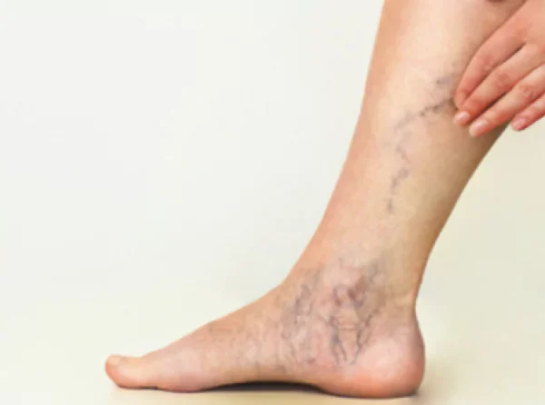 2a0ygqfrzyfcociqfxoxtraoe0jluu66nb87f8ez (2)