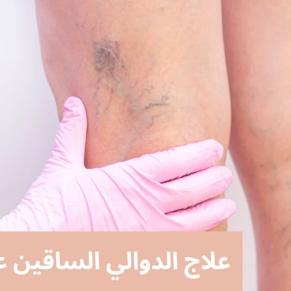 علاج الدوالي الساقين عند النساء 20250415 151639 0000