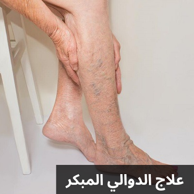 علاج الدوالي المبكر 20250429 015629 0000