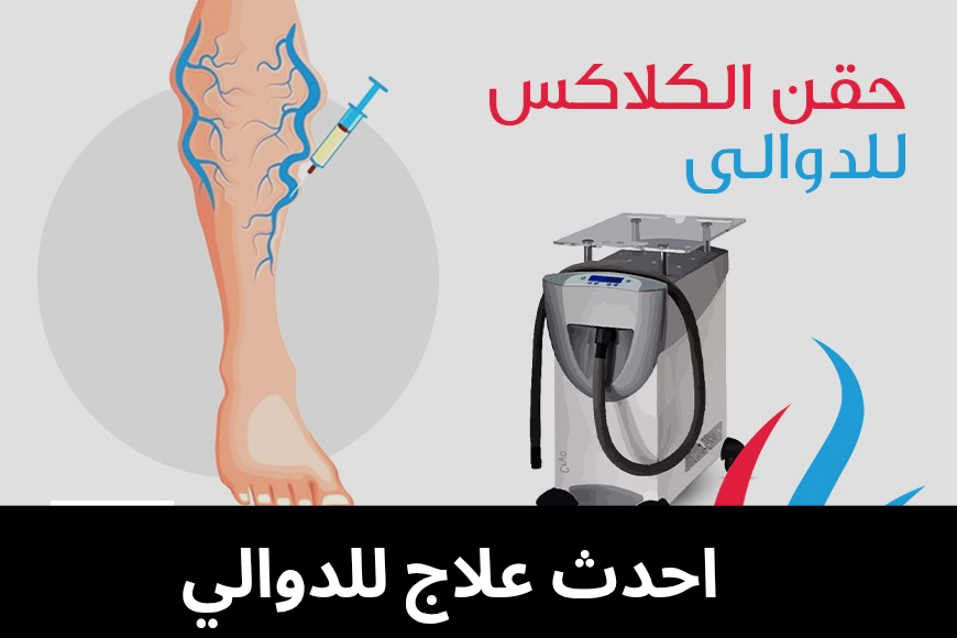 احدث علاج للدوالي 20250512 022912 0000