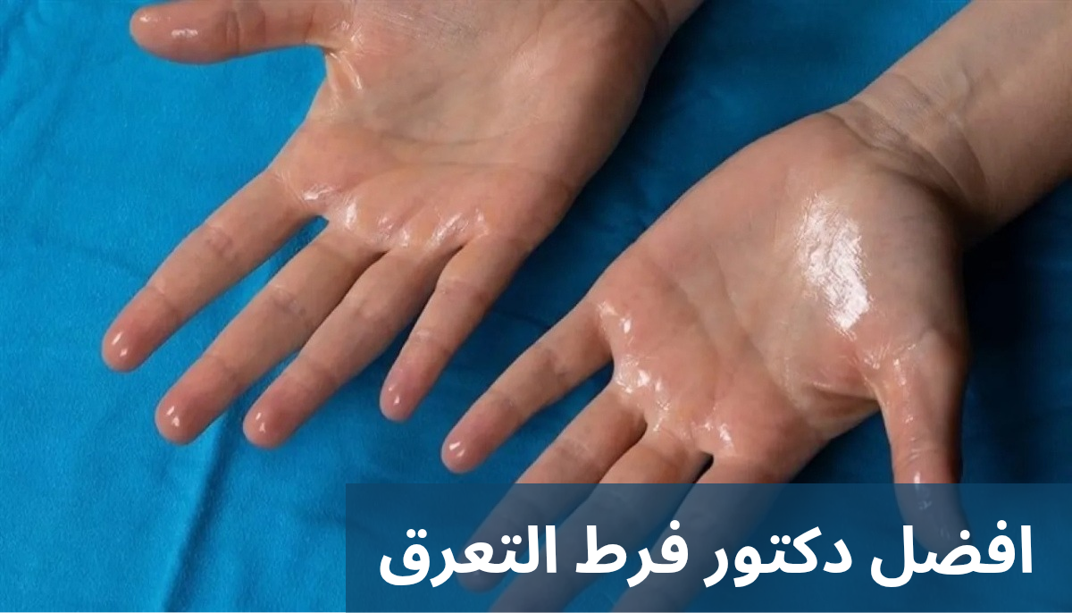 افضل دكتور فرط التعرق 20250518 004104 0000