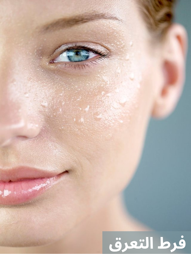 فرط التعرق 20250513 053133 0000