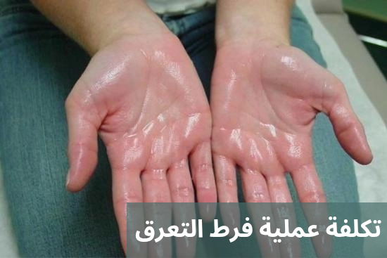 تكلفة عملية فرط التعرق 20250622 024640 0000